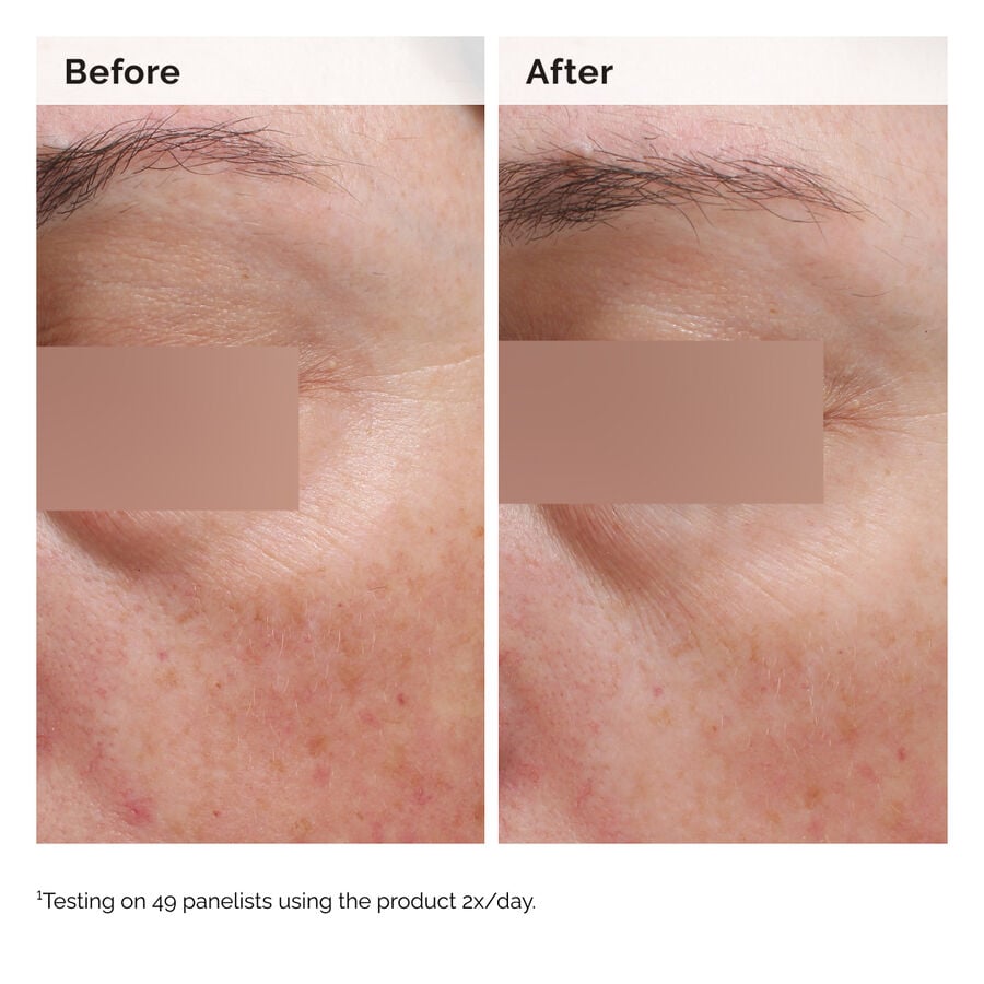 niacinamide-5-face-and-body-emulsion-g5 2024-08-23-ORD-Nia-5pct-Face-Body-B-A-Elasticity-Global-02-1x1.jpg