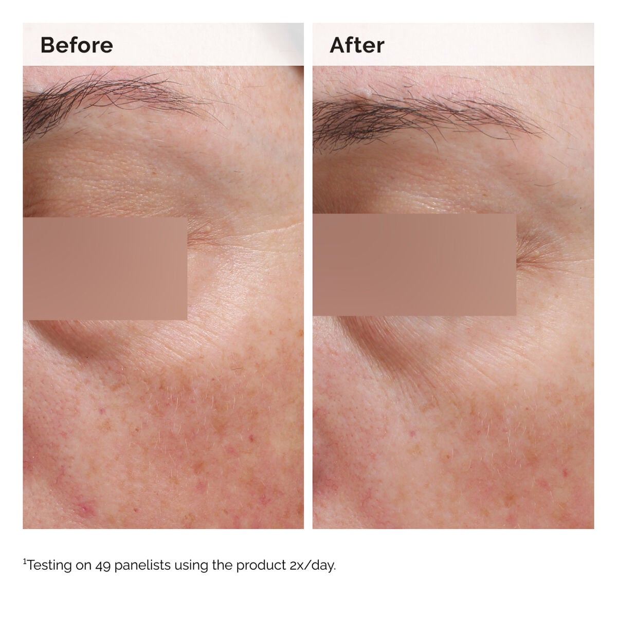 niacinamide-5-face-and-body-emulsion-g5 2024-08-23-ORD-Nia-5pct-Face-Body-B-A-Elasticity-Global-02-1x1.jpg