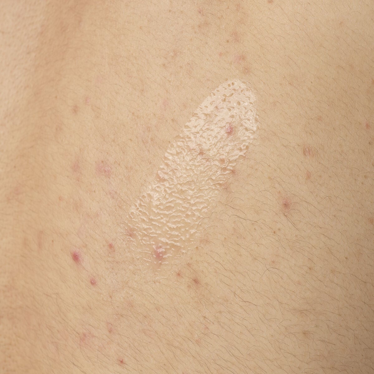 salicylic-acid-0-5-body-serum-n4 ORD-salicylic-acid-05-body-240ml-application.jpg