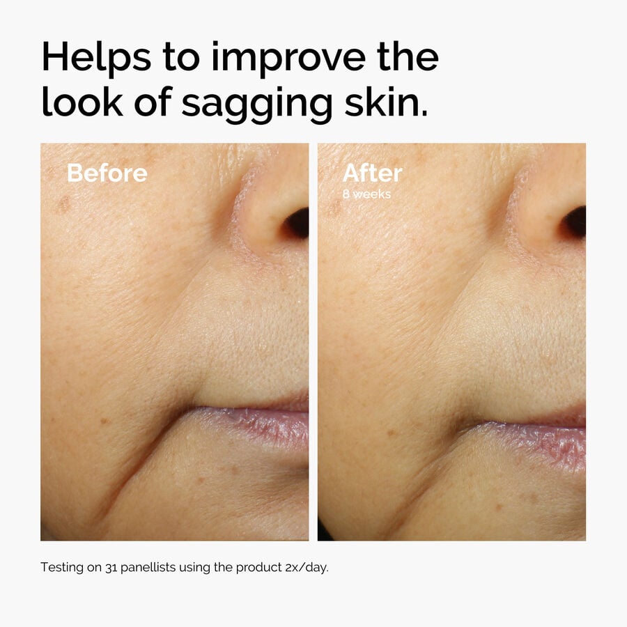 caffeine-3-escin-1-face-serum-d2 ord-caffeine-3pct-escin-1pct-face-serum-before-after-sagging.jpg