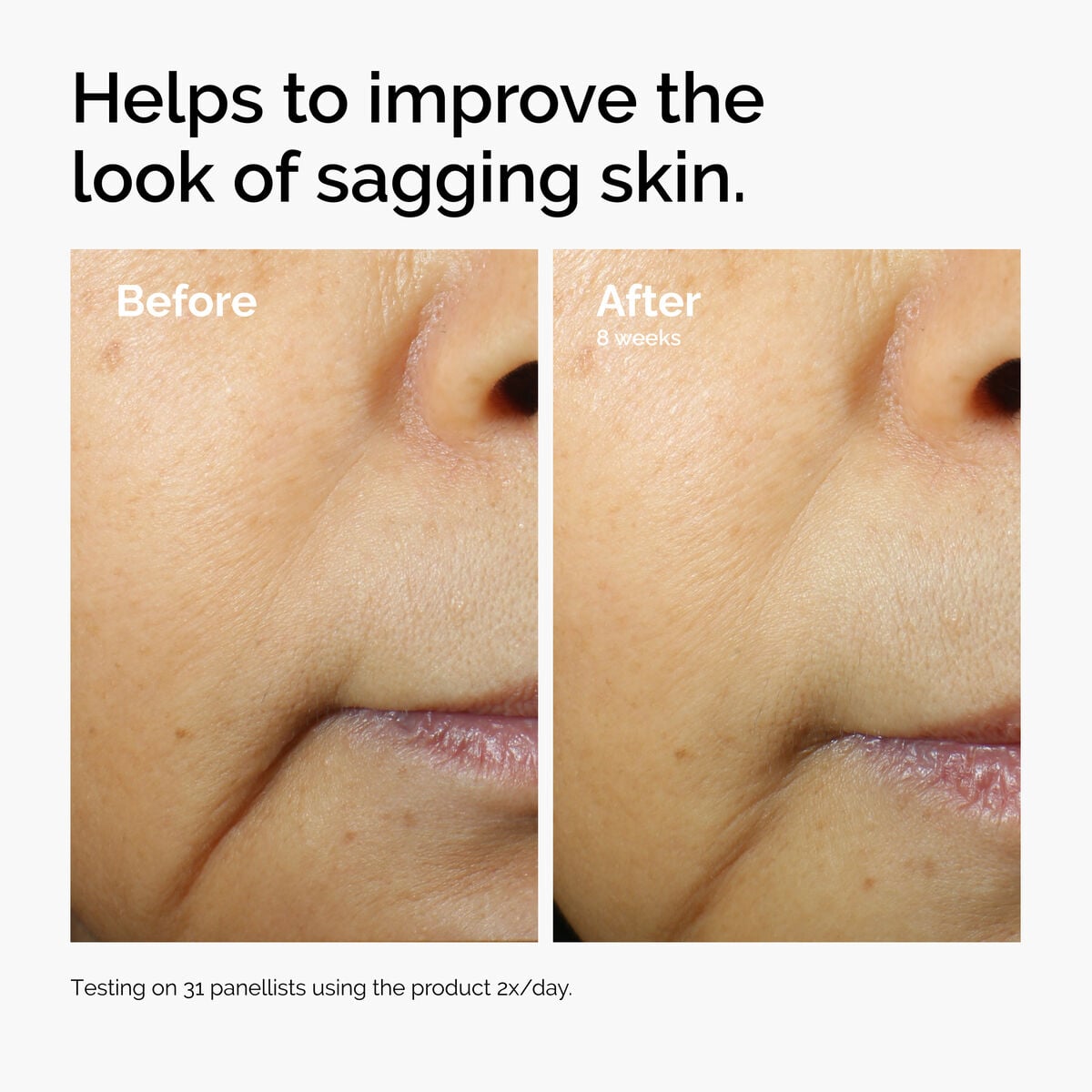 caffeine-3-escin-1-face-serum-d2 ord-caffeine-3pct-escin-1pct-face-serum-before-after-sagging.jpg