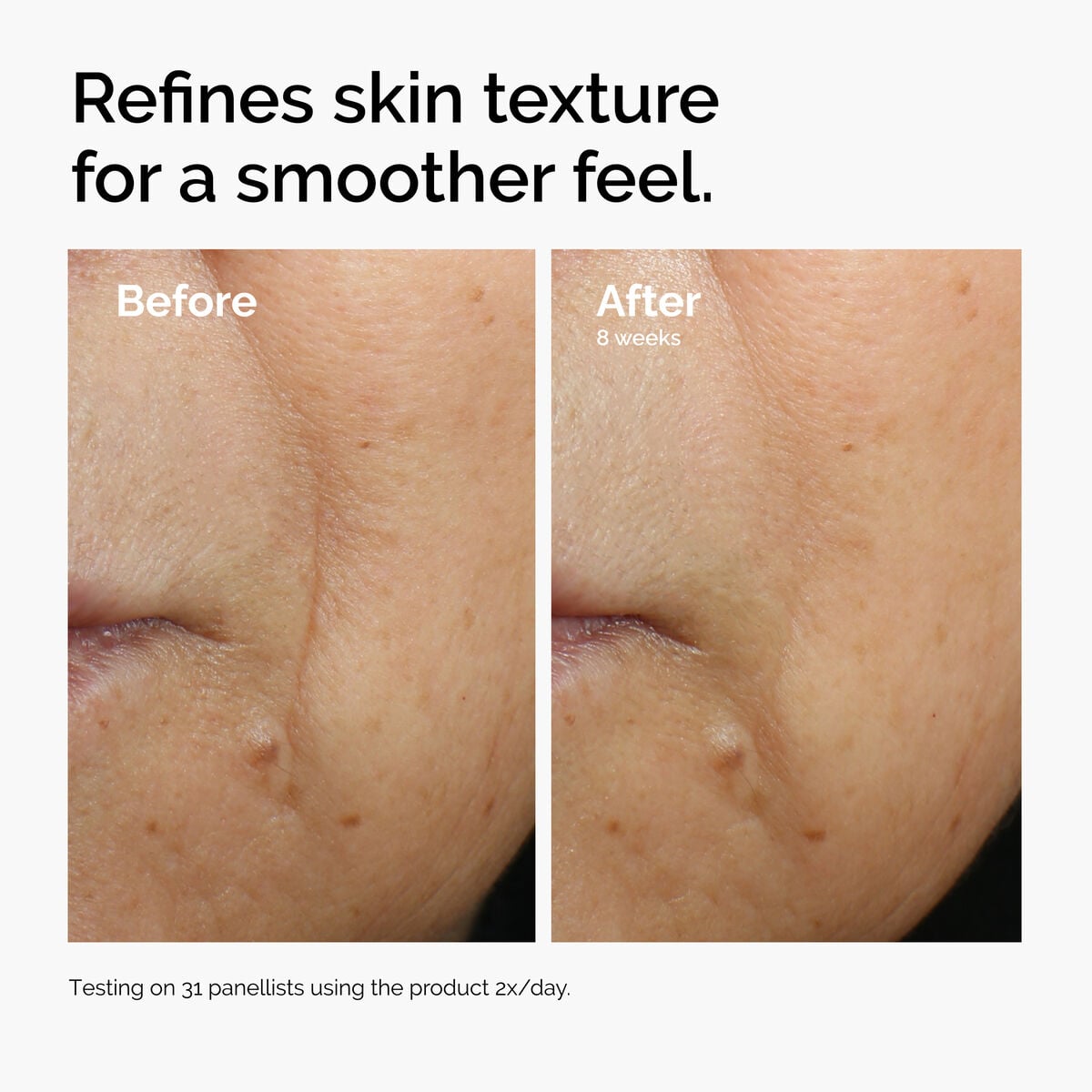 caffeine-3-escin-1-face-serum-d2 ord-caffeine-3pct-escin-1pct-face-serum-before-after-texture.jpg