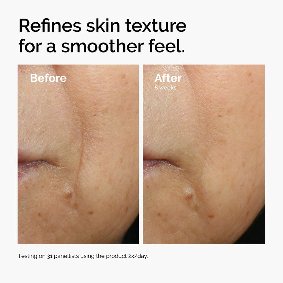 caffeine-3-escin-1-face-serum-d2 ord-caffeine-3pct-escin-1pct-face-serum-before-after-texture.jpg