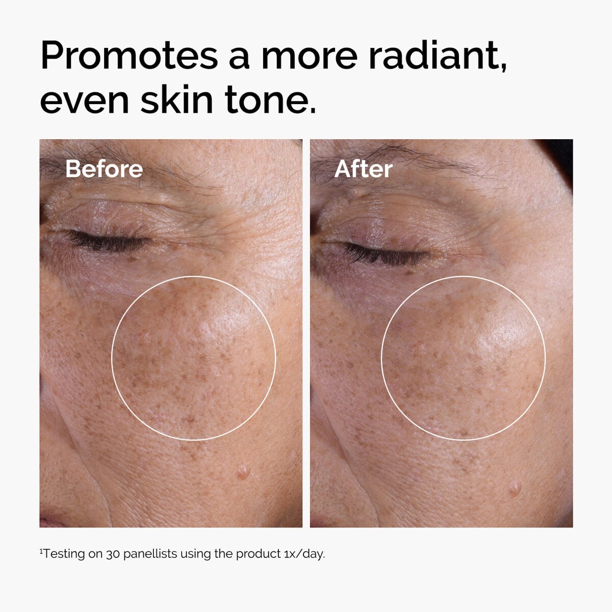 glycolic-acid-7-exfoliating-toner-w8 ord-glycolic-before-after-radiance.jpg