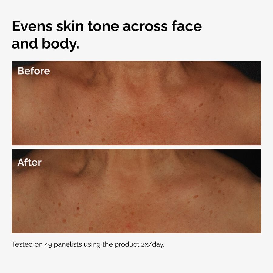 the-body-care-collection-v1 ord-niacinamide-face-body-serum-before-after-even-tone-graphic.jpg
