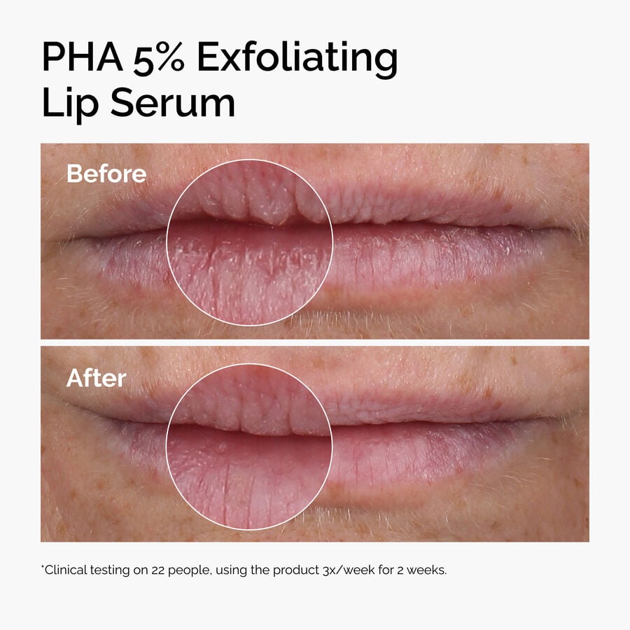 pha-5-exfoliating-lip-serum-f4 ord-pha-5pct-lip-exfoliating-serum-before-after.jpg