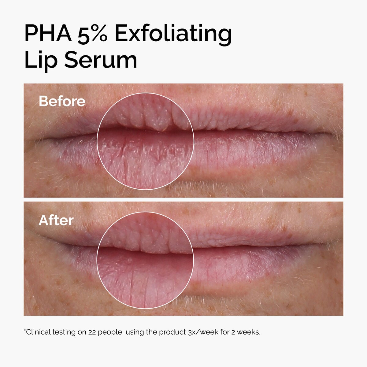 pha-5-exfoliating-lip-serum-f4 ord-pha-5pct-lip-exfoliating-serum-before-after.jpg